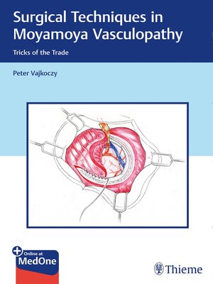 cover image of Surgical Techniques in Moyamoya Vasculopathy